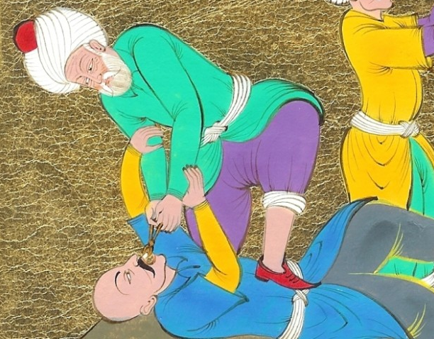 18th-19th century illustration of dental surgery as practiced by Ottoman Turks